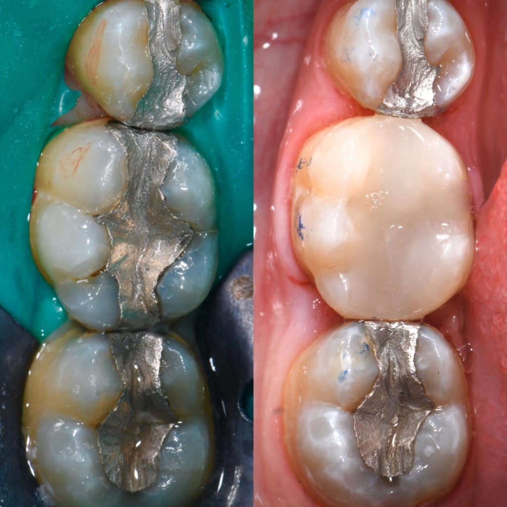 Biomimetic Dentistry2