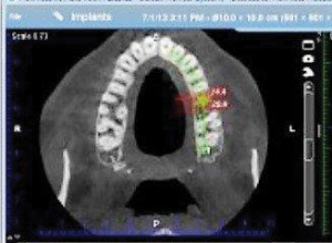 CBCT-Scan-2