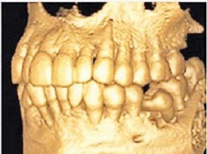 CBCT-Scan-5