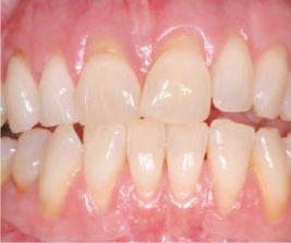 Preventive Care (Periodontal Disease)-2