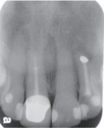 CBCT-Scan-2